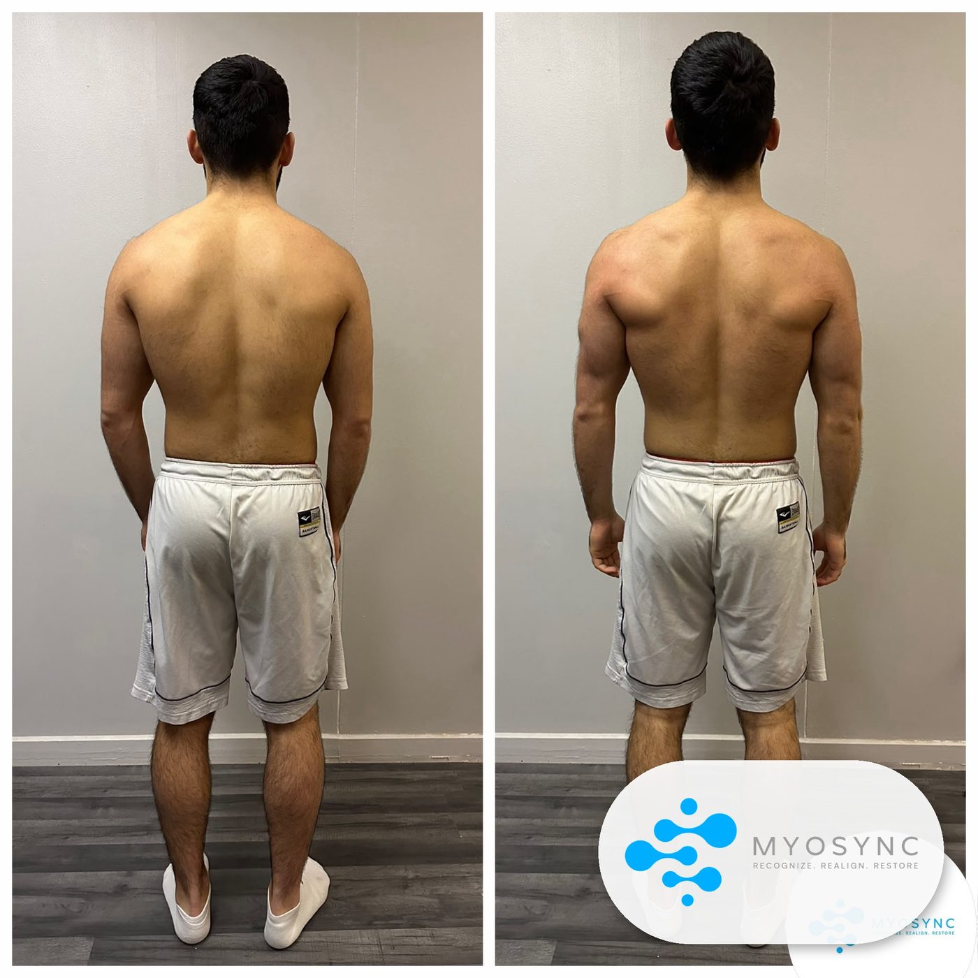 Posture<br>Before & After