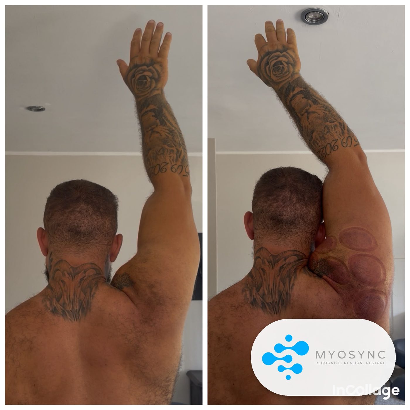Mobility<br>Before & After